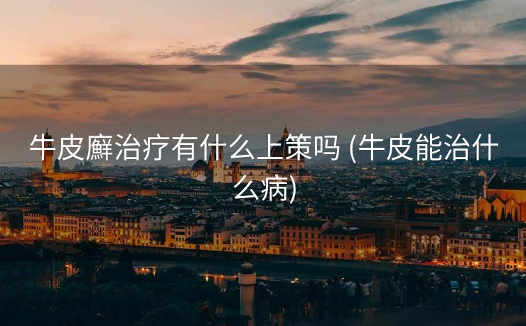 牛皮廯治疗有什么上策吗 (牛皮能治什么病)