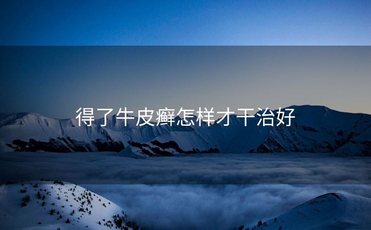 得了牛皮癣怎样才干治好