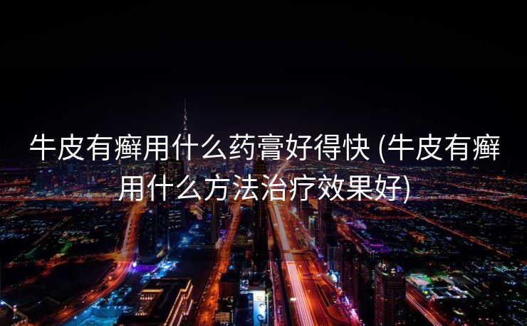 牛皮有癣用什么药膏好得快 (牛皮有癣用什么方法治疗效果好)